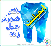 ایمپلنت در رشت گیلان